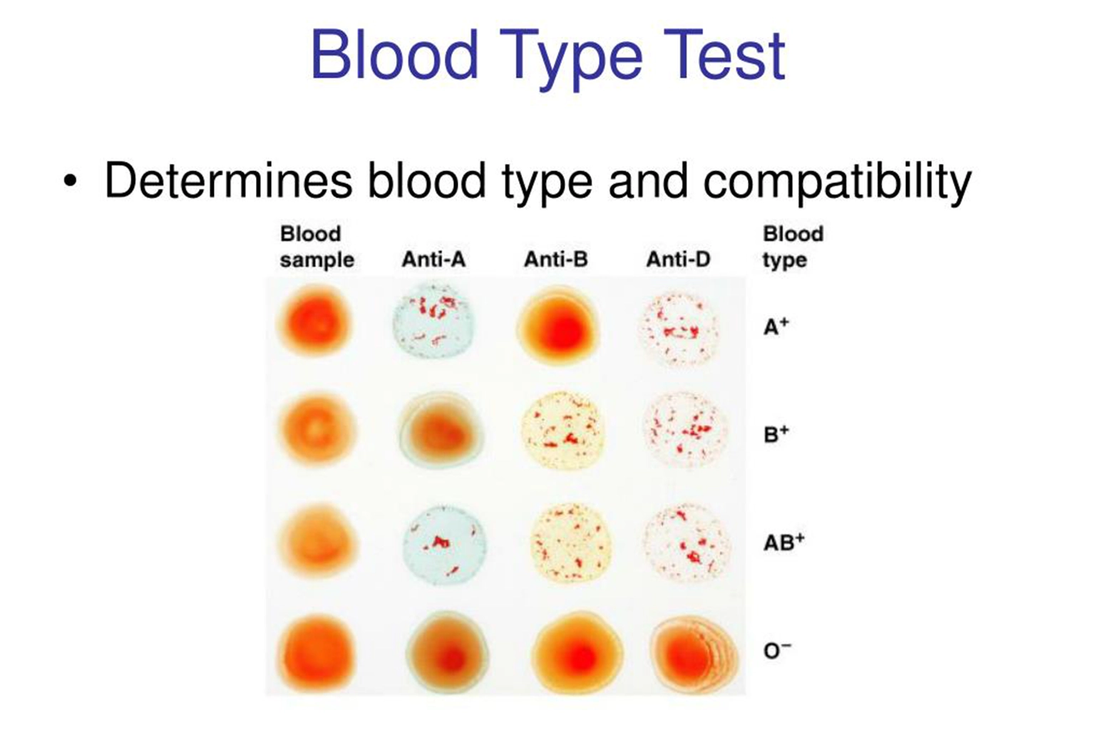 Kan Grubu Testi Nedir? Nasıl Yapılır?
