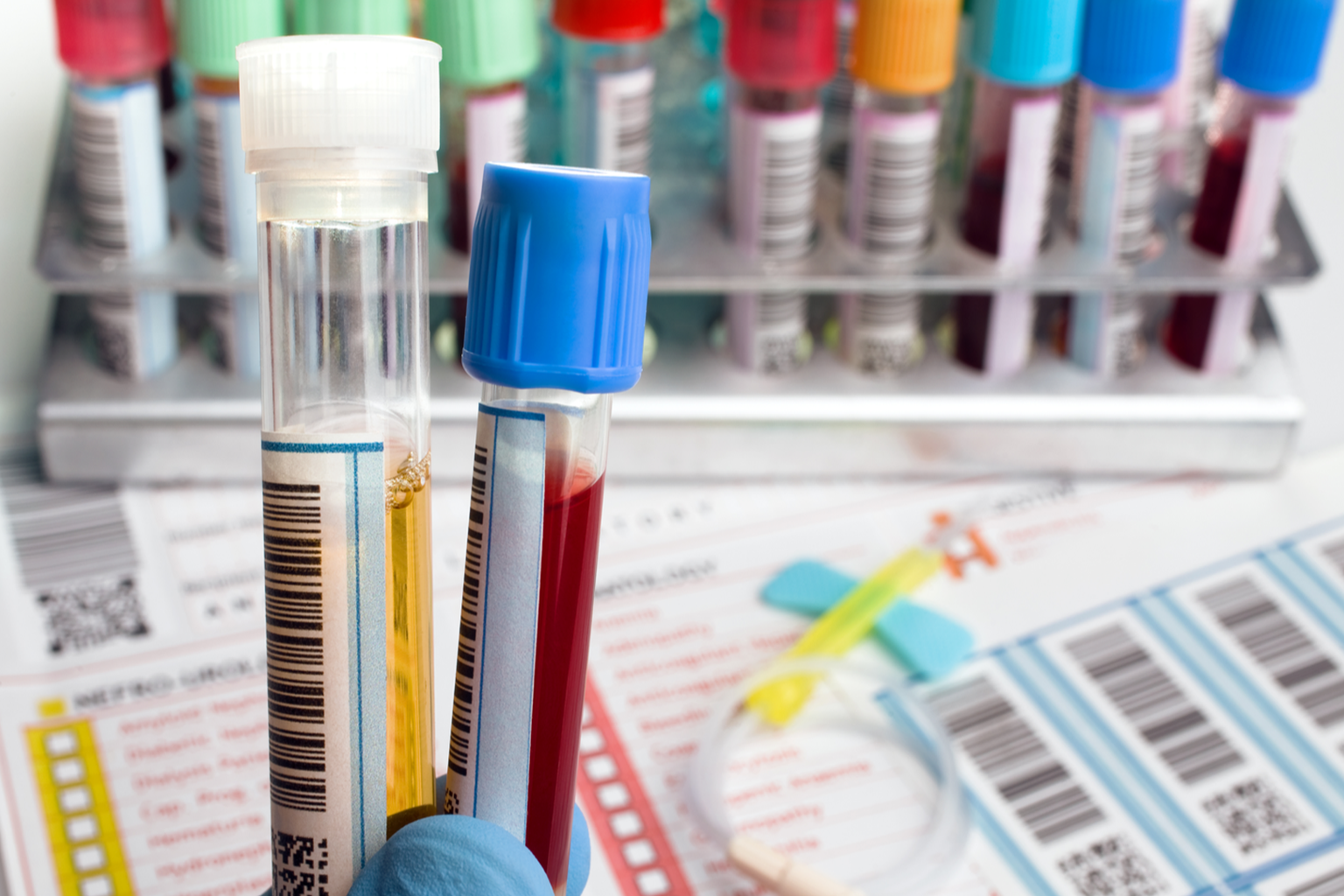 Akıllı İlaç Gen Testi Nedir? Nasıl Yapılır?